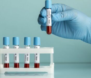 Simples exame de sangue pode revolucionar identificação de Alzheimer