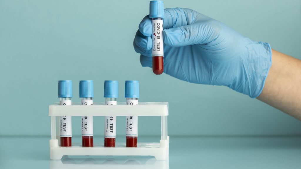 No momento você está vendo Simples exame de sangue pode revolucionar identificação de Alzheimer