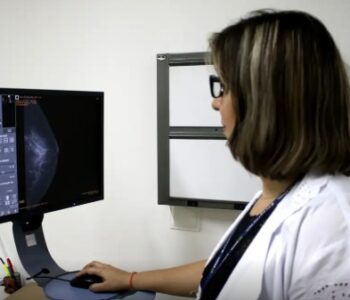 Entidades médicas pedem faixa etária maior para mamografia de rastreio