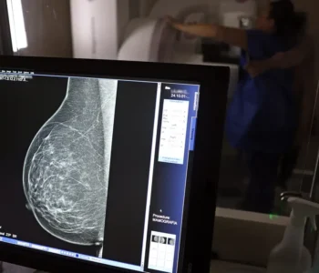 Ministério da Saúde passa a recomendar mamografia a partir dos 40 anos