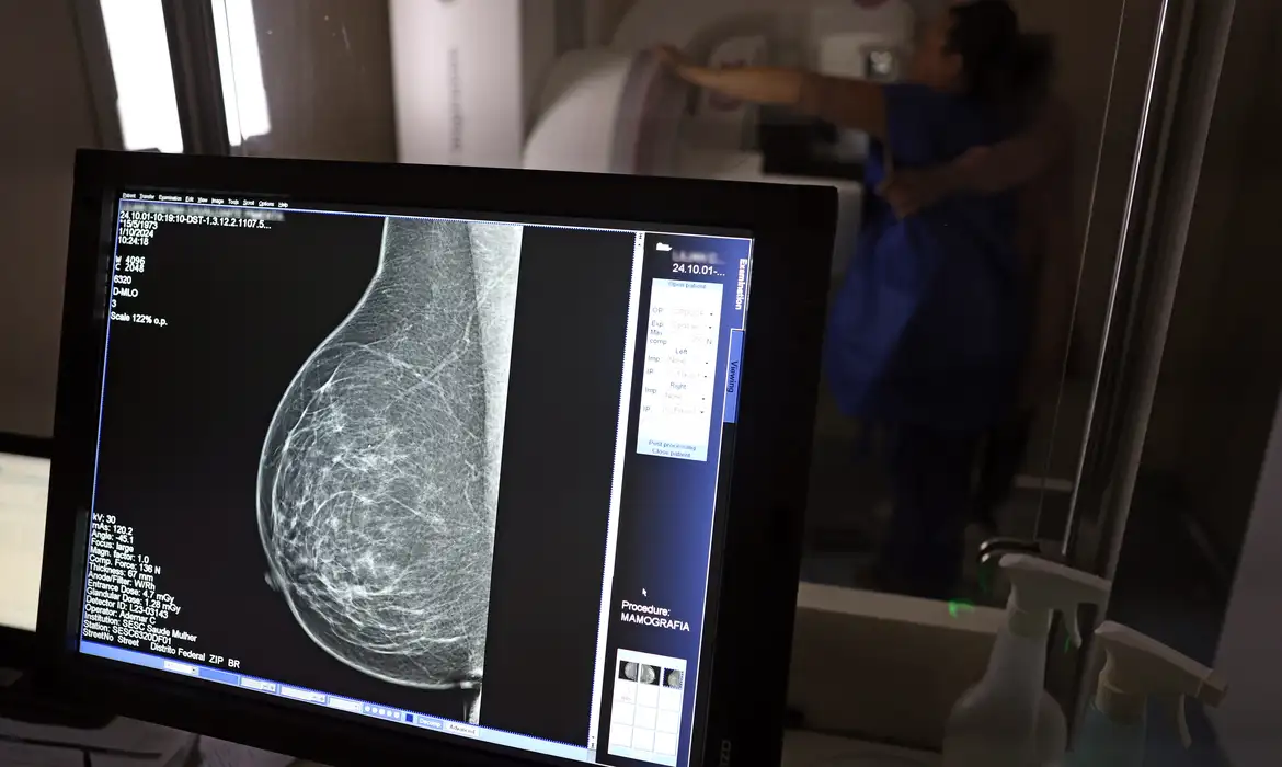 No momento você está vendo Ministério da Saúde passa a recomendar mamografia a partir dos 40 anos