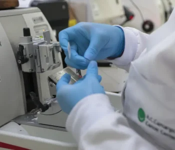 Cura de câncer de próstata pode chegar a até 98% 