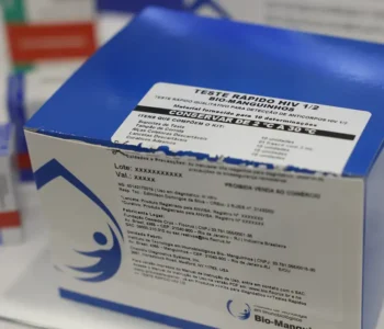 Fiocruz vai ampliar produção de kits diagnósticos para o SUS