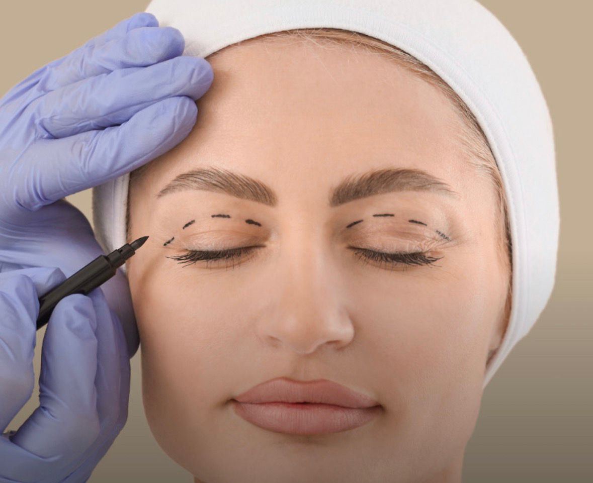 No momento você está vendo “Cirurgia do olhar” ultrapassa lipoaspiração como a plástica mais realizada no mundo