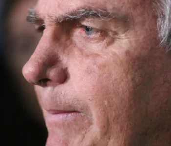 Com crise persistente de soluços, Bolsonaro faz nova cirurgia