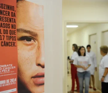 Casos de câncer de pele saltam de 4 mil para mais de 72 mil em 10 anos