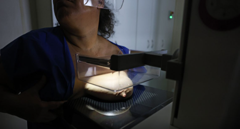 No momento você está vendo Vigitel: 92% das brasileiras entre 50 e 69 anos fizeram mamografia