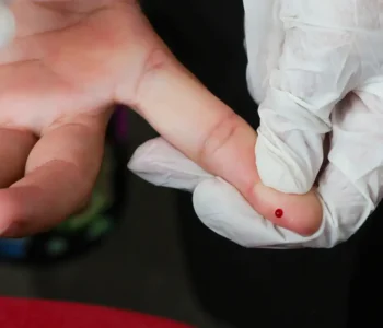 SUS passa a oferecer teste rápido de dengue