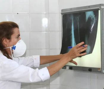 OMS recomenda testes de diagnóstico rápido para erradicar tuberculose