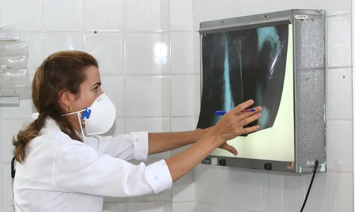 No momento você está vendo OMS recomenda testes de diagnóstico rápido para erradicar tuberculose