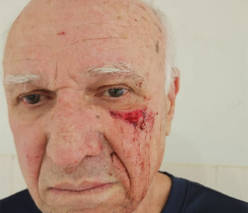 Empresário registra ocorrência de agressão em frente à sua loja em Barreiras