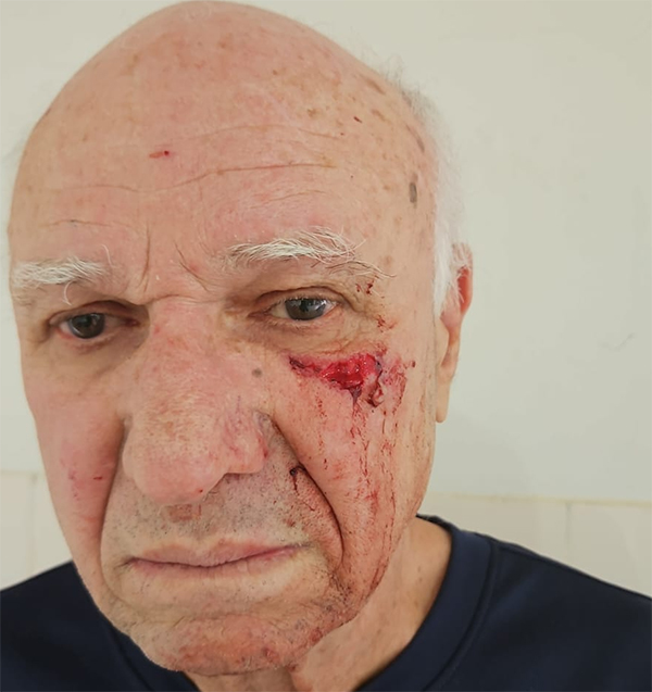 No momento você está vendo Empresário registra ocorrência de agressão em frente à sua loja em Barreiras
