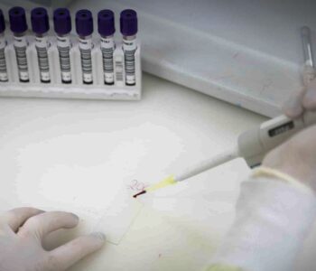 Exames descartam ebola em imigrante da República Democrática do Congo