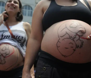 Fatores sociais e estruturais empurram mulheres para cesarianas