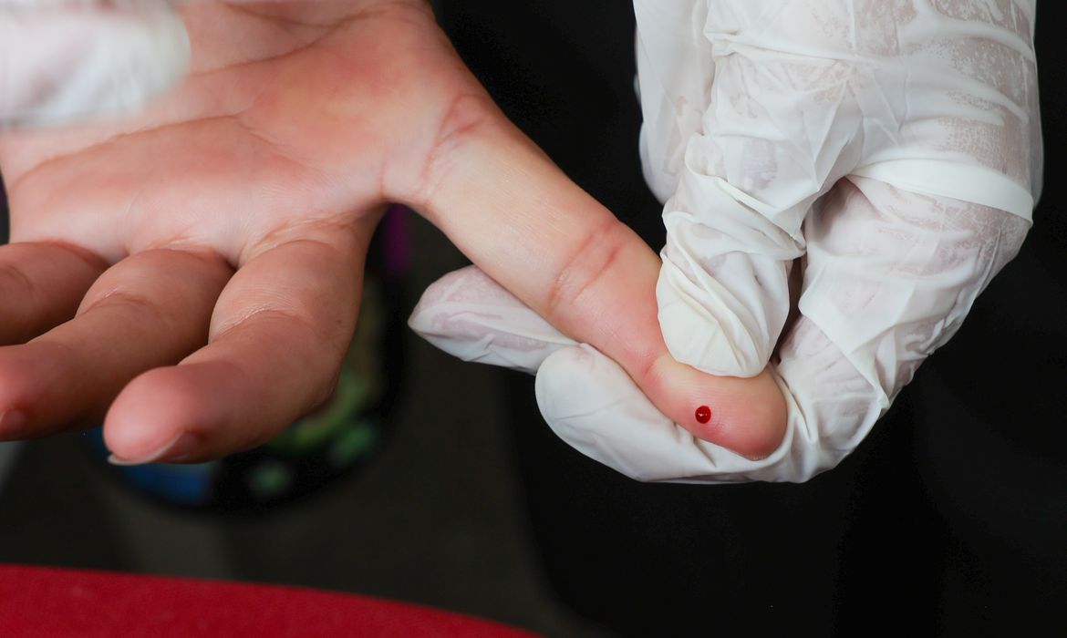 No momento você está vendo Brasil atinge meta de redução da transmissão vertical de hepatite B