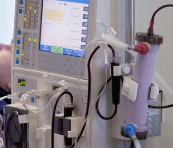 Estudo alerta para subdiagnóstico da doença renal crônica no Brasil