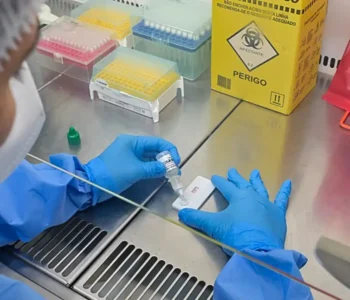 Anvisa atualiza regras sobre controle de qualidade em laboratórios